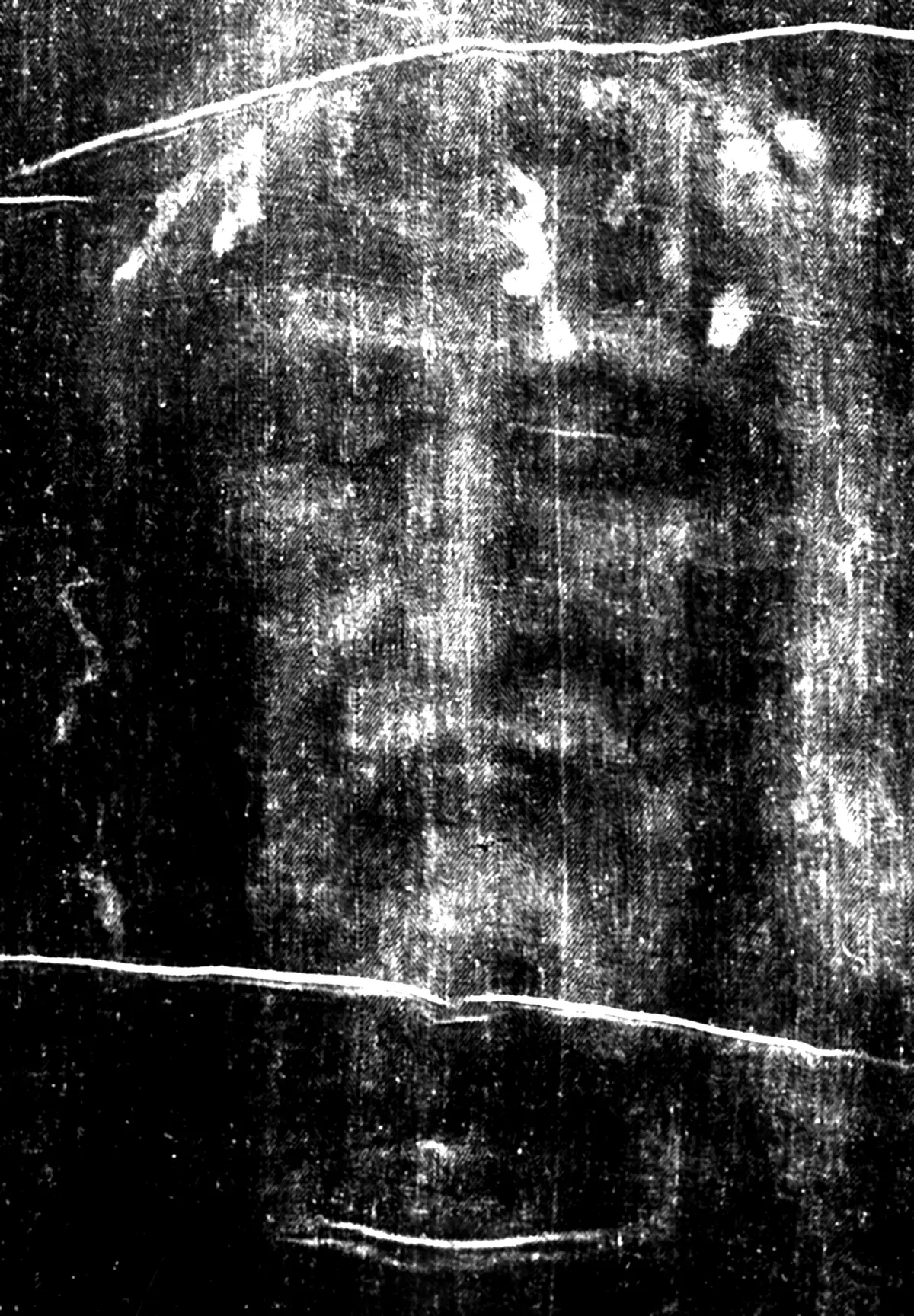 Das Gesicht auf dem Grabtuch im Negativ: ein bärtiger Mann mit geschlossenen Augen, die Nase leicht zur Seite gedrückt, Blutfäden auf der Stirn.